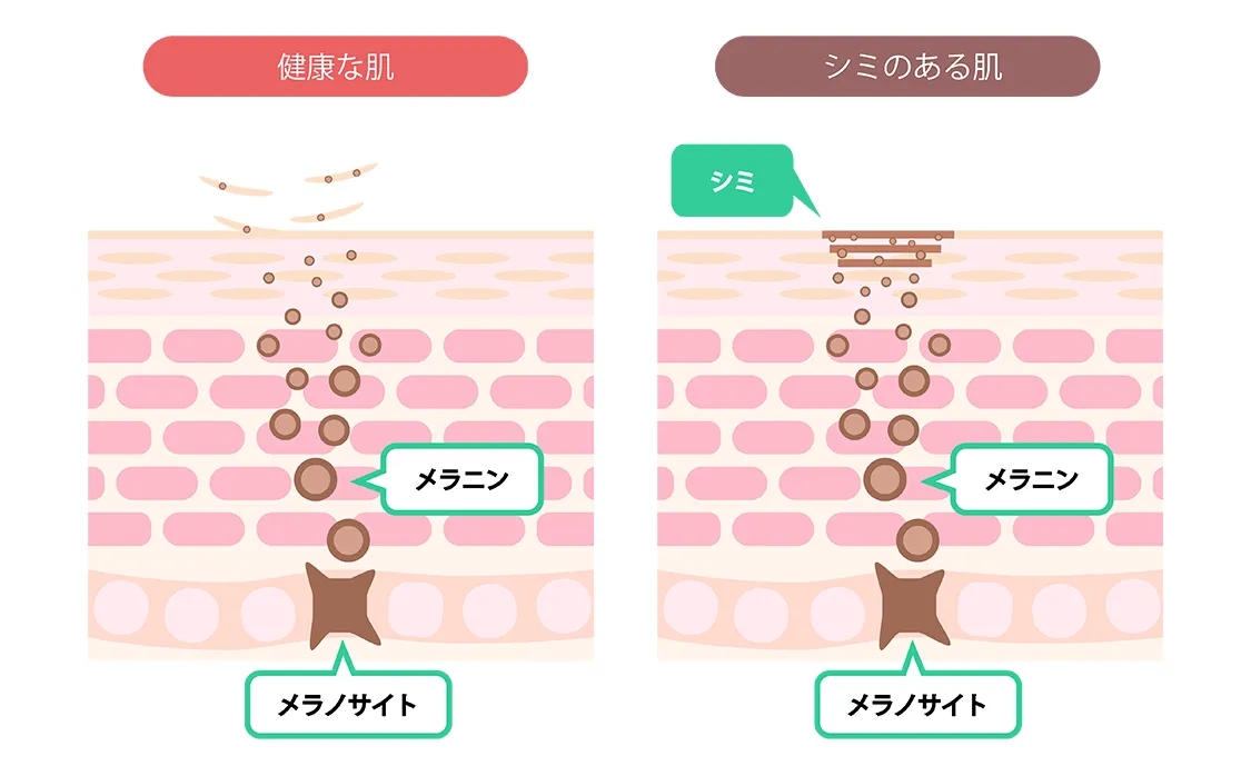 メラニンの図解